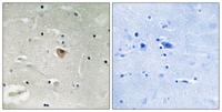 KIF13B Polyclonal Antibody