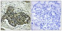 KIF20A Polyclonal Antibody