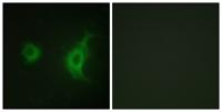 KIF20A Polyclonal Antibody