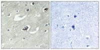 KIF20A Polyclonal Antibody