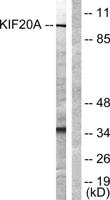 KIF20A Polyclonal Antibody