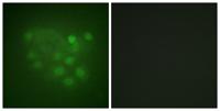 KIF2C Polyclonal Antibody