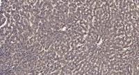 KIF4A Polyclonal Antibody