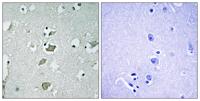 KIR2.1 Polyclonal Antibody