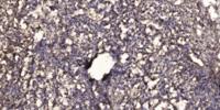 KIR2.3 Polyclonal Antibody