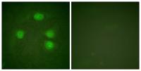 KIR3.1 Polyclonal Antibody