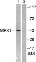 KIR3.1 Polyclonal Antibody