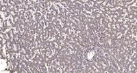 KIR3.1 Polyclonal Antibody
