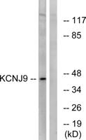 KIR3.3 Polyclonal Antibody