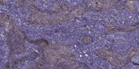 KIR3.4 Polyclonal Antibody