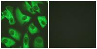 KIR5.1 Polyclonal Antibody