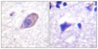 KIR5.1 Polyclonal Antibody