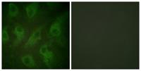 KIR6.2 Polyclonal Antibody