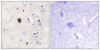KIR6.2 Polyclonal Antibody