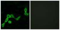 KiSS-1R Polyclonal Antibody