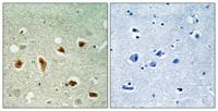 KKIALRE Polyclonal Antibody