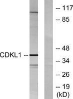 KKIALRE Polyclonal Antibody