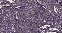 KKIAMRE Polyclonal Antibody