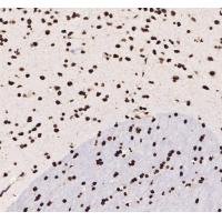 KLF12 Polyclonal Antibody