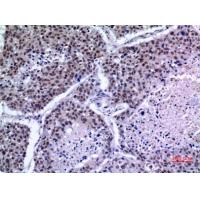 KLF13 Polyclonal Antibody