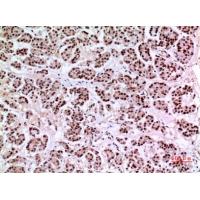 KLF13 Polyclonal Antibody