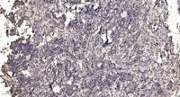 KLF7 Polyclonal Antibody