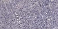 KLF8 Polyclonal Antibody