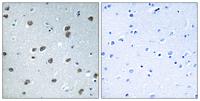 KLHL29 Polyclonal Antibody