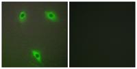 KLHL3 Polyclonal Antibody