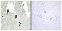 KLHL3 Polyclonal Antibody
