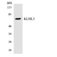 KLHL3 Polyclonal Antibody