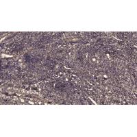KLK1 Polyclonal Antibody