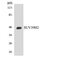 KMT1B Polyclonal Antibody