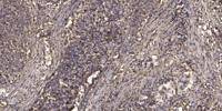 KMT1B Polyclonal Antibody