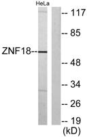 KOX11 Polyclonal Antibody