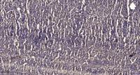 KOX11 Polyclonal Antibody
