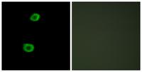 KPI-2 Polyclonal Antibody