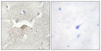 KPI-2 Polyclonal Antibody