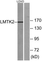 KPI-2 Polyclonal Antibody