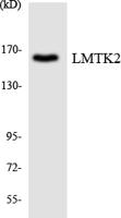 KPI-2 Polyclonal Antibody