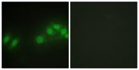 Kpm Polyclonal Antibody