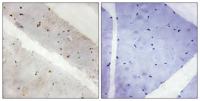 Kpm Polyclonal Antibody