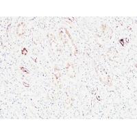 K-Ras Polyclonal Antibody