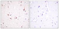 Krs-1/2 Polyclonal Antibody
