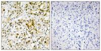 Galectin-4 Polyclonal Antibody