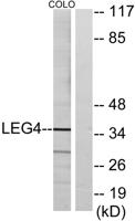 Galectin-4 Polyclonal Antibody