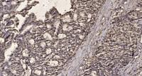Galectin-7 Polyclonal Antibody
