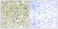 Galectin-8 Polyclonal Antibody