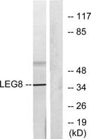 Galectin-8 Polyclonal Antibody