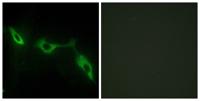 Galectin-9 Polyclonal Antibody